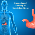 Diagnosis and Screening for Gastric Conditions